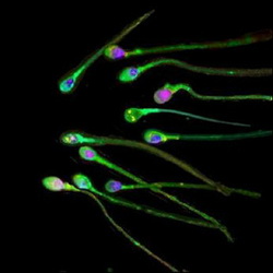 Sperm Banks in the UK